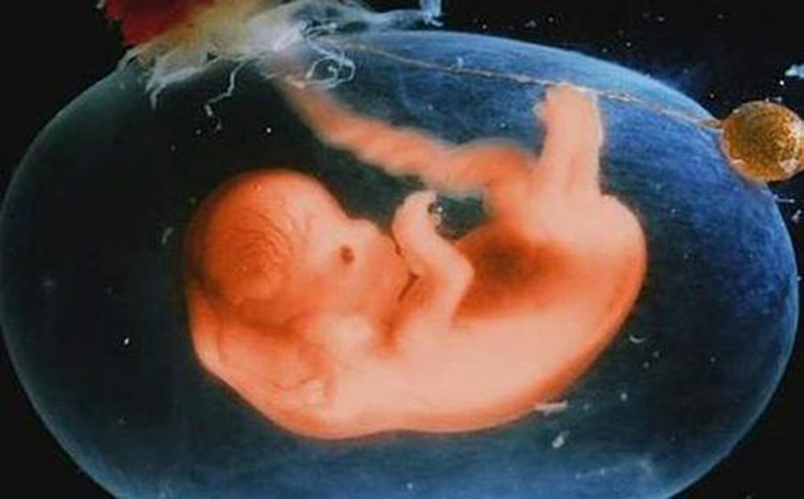 12周胎儿发育指标 第2张-备孕-孕期检查-孕产妇食谱-胎教育儿