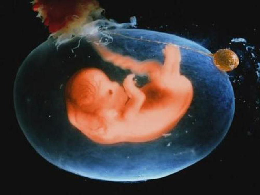 20周胎儿发育指标 第2张-备孕-孕期检查-孕产妇食谱-胎教育儿