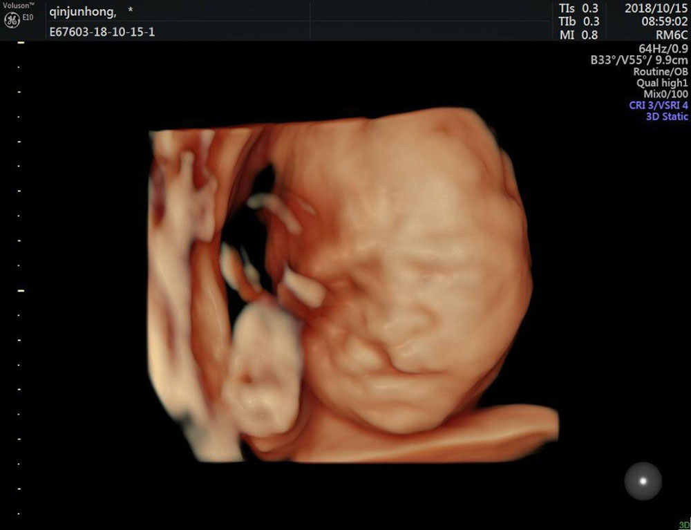 27周胎儿发育指标 第2张-备孕-孕期检查-孕产妇食谱-胎教育儿