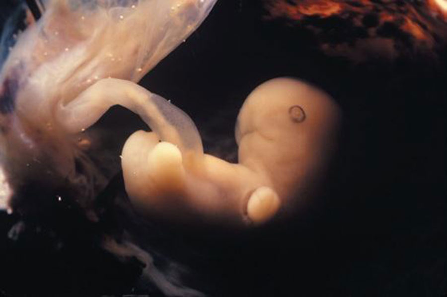 5周胎儿发育指标 第2张-备孕-孕期检查-孕产妇食谱-胎教育儿