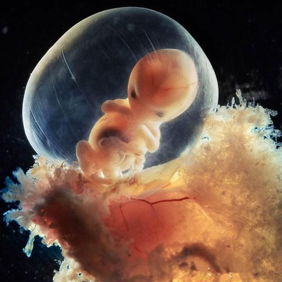 8周胎儿发育指标 第2张-备孕-孕期检查-孕产妇食谱-胎教育儿